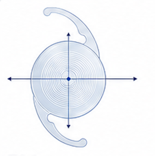 Lente intraocular tórico